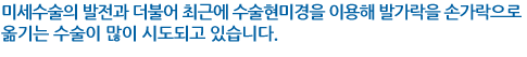 미세수술의 발전과 더불어 최근에 수술현미경을 이용해 발가락을 손가락으로 옮기는 수술이 많이 시도되고 있습니다. 