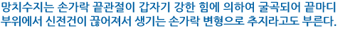 망치수지는 손가락 끝관절이 갑자기 강한 힘에 의하여 굴곡되어 끝마디 부위에서 신전건이 끊어져서 생기는 손가락 변형으로 추지라고도 부른다.