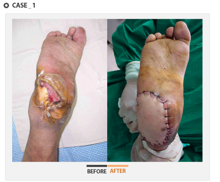 case1 - 수술 전후 사진