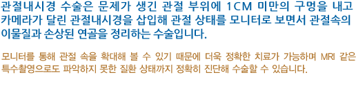 관절내시경 수술은 문제가 생긴 관절 부위에 1cm 미만의 구멍을 내고 카메라가 달린 관절내시경을 삽입해 관절 상태를 모니터로 보면서 관절속의 이물질과 손상된 연골을 정리하는 수술입니다. 모니터를 통해 관절 속을 확대해 볼 수 있기 때문에 더욱 정확한 치료가 가능하며 MRI 같은 특수촬영으로도 파악하지 못한 질환 상태까지 정확히 진단해 수술할 수 있습니다.